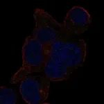 Atlas Antibodies Anti-LRRCC1 Antibody