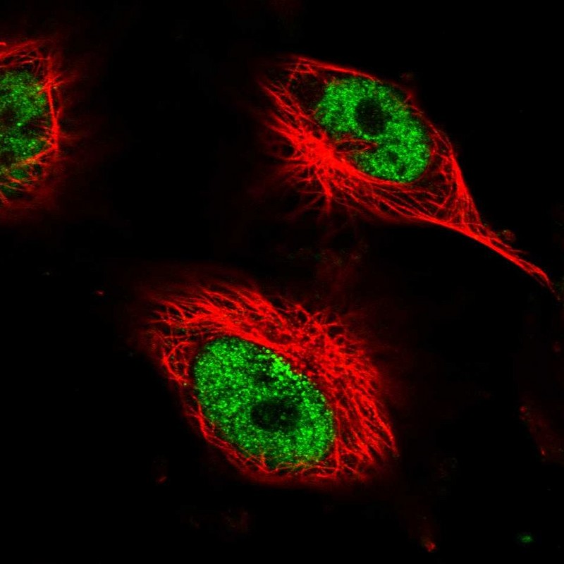 Atlas Antibodies Anti-AHDC1 Antibody