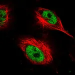 Atlas Antibodies Anti-AHDC1 Antibody