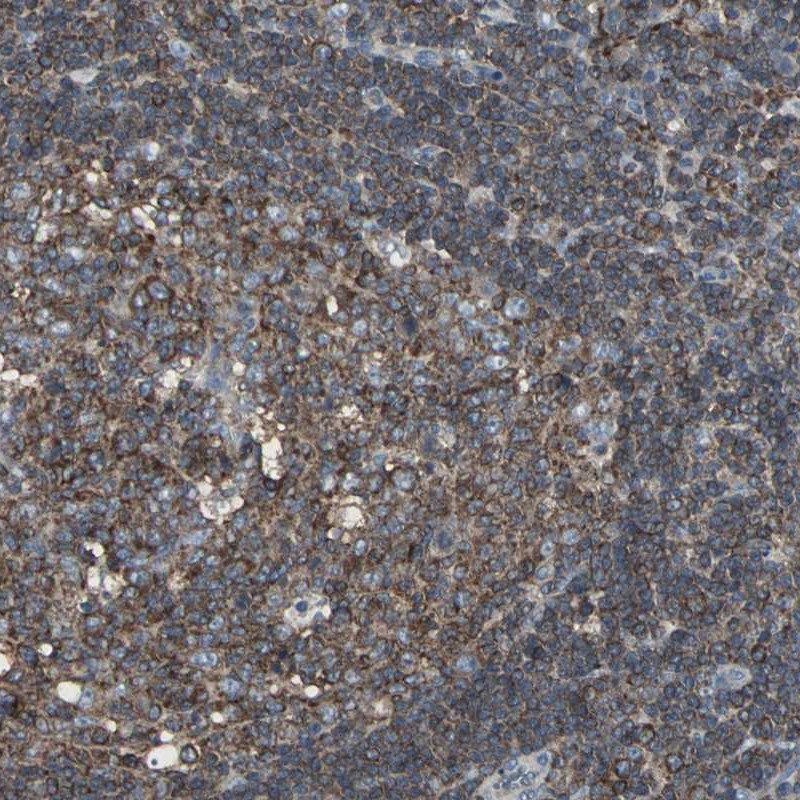 Atlas Antibodies Anti-LRRFIP1 Antibody