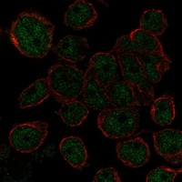 Atlas Antibodies Anti-AHDC1 Antibody
