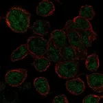 Atlas Antibodies Anti-AHDC1 Antibody