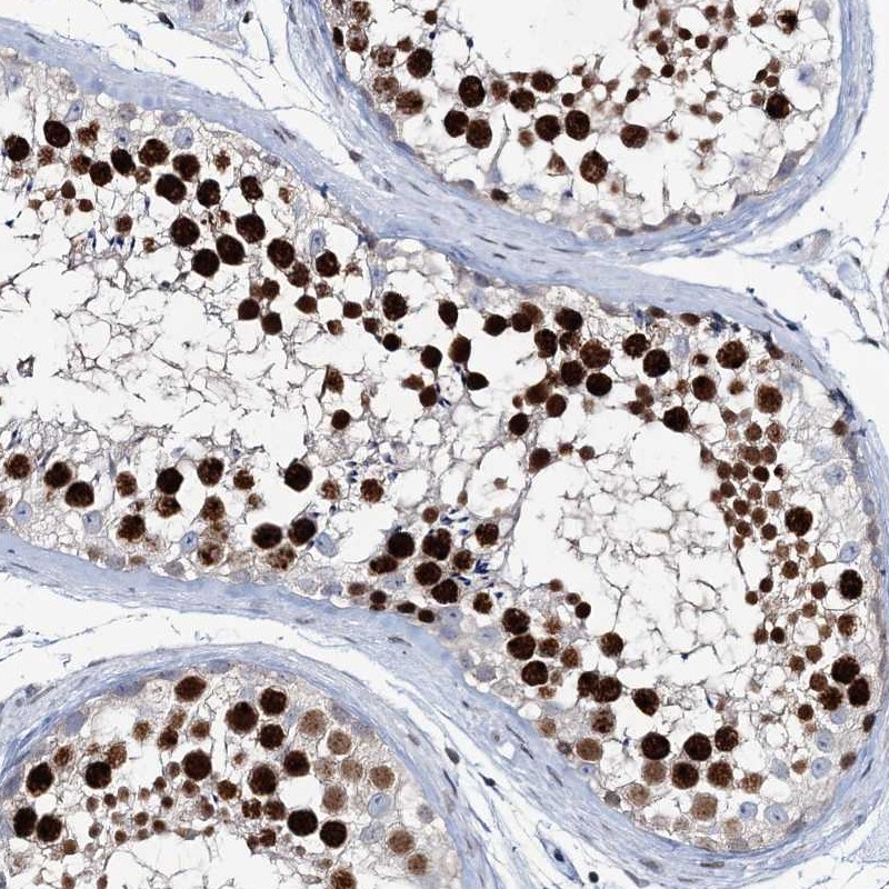 Atlas Antibodies Anti-LRRFIP2 Antibody