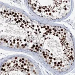 Atlas Antibodies Anti-LRRFIP2 Antibody