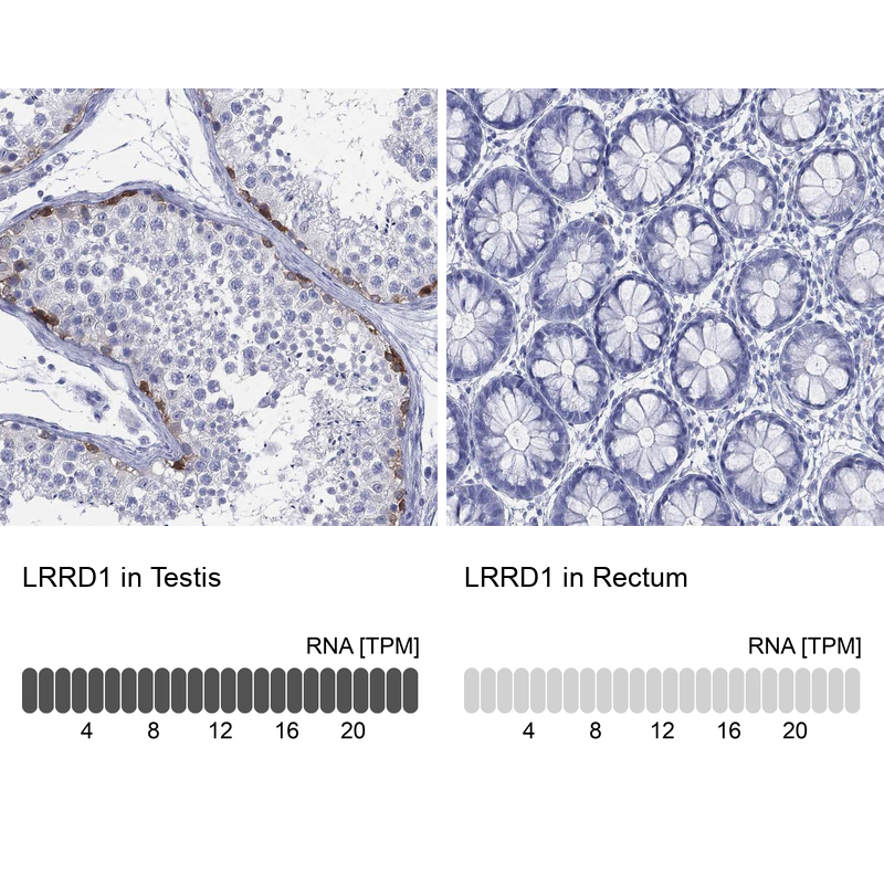 Atlas Antibodies Anti-LRRD1 Antibody
