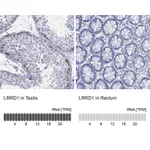 Atlas Antibodies Anti-LRRD1 Antibody