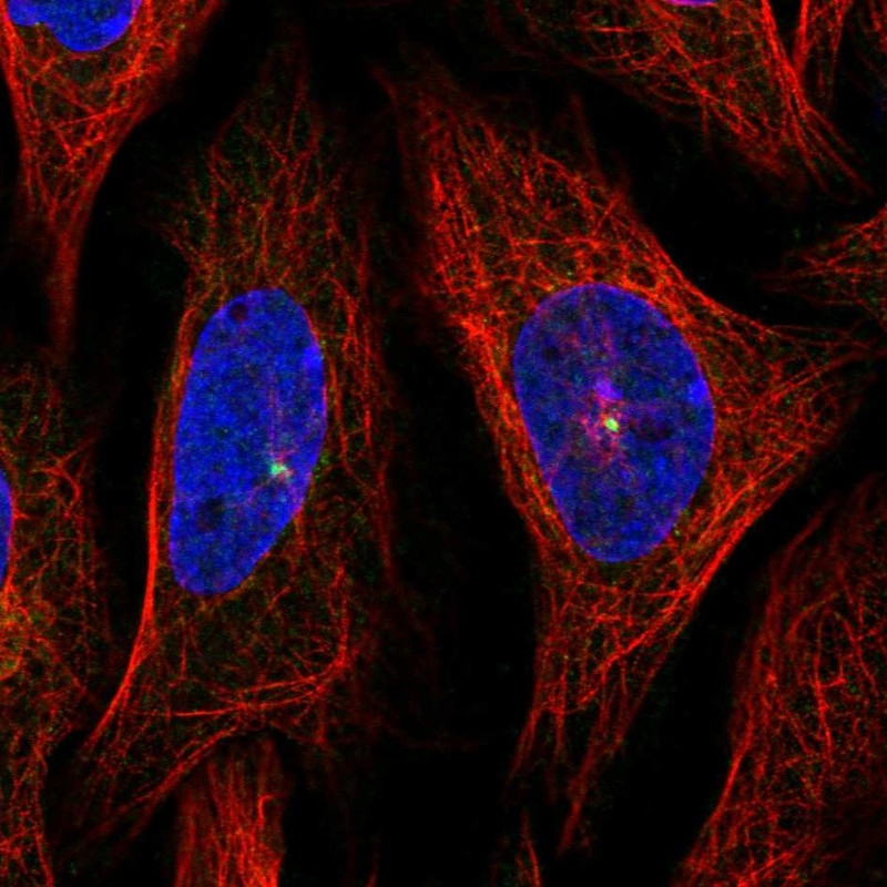 Atlas Antibodies Anti-AHI1 Antibody