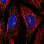 Atlas Antibodies Anti-AHI1 Antibody