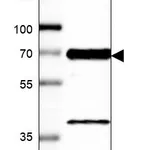 Atlas Antibodies Anti-LRRFIP2 Antibody