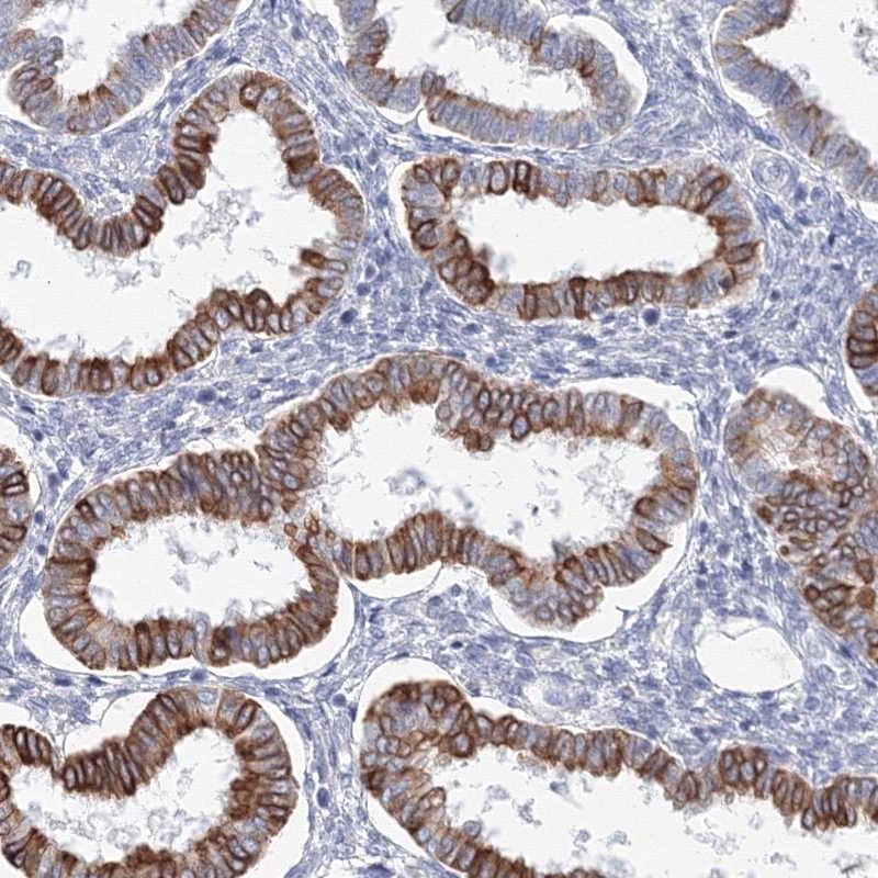 Atlas Antibodies Anti-LRRIQ4 Antibody