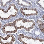 Atlas Antibodies Anti-LRRIQ4 Antibody