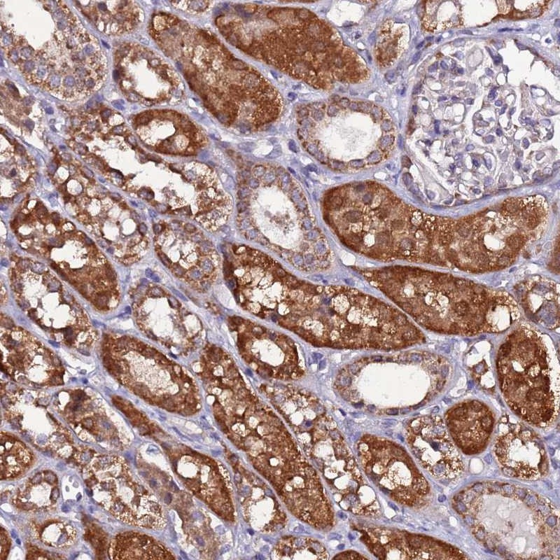 Atlas Antibodies Anti-AHI1 Antibody