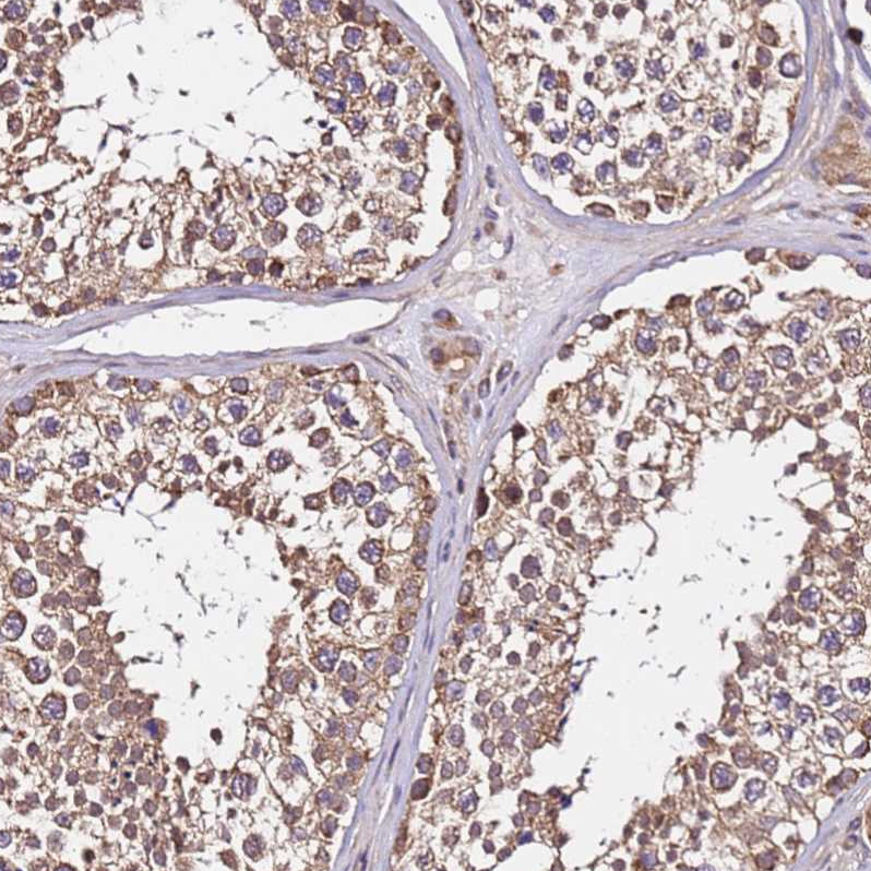 Atlas Antibodies Anti-LRRIQ1 Antibody