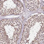 Atlas Antibodies Anti-LRRIQ1 Antibody