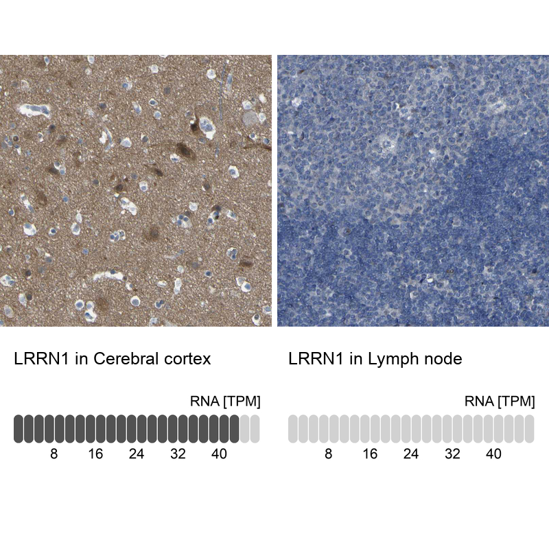 Atlas Antibodies Anti-LRRN1 Antibody