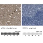 Atlas Antibodies Anti-LRRN1 Antibody