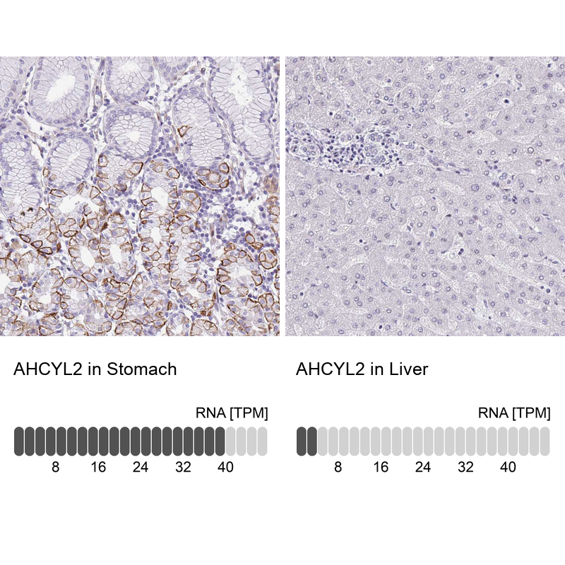 Atlas Antibodies Anti-AHCYL2 Antibody