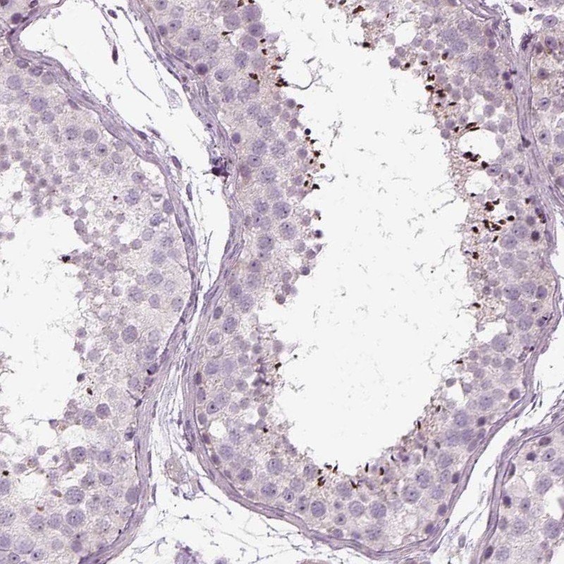Atlas Antibodies Anti-LRRIQ3 Antibody
