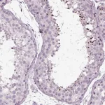 Atlas Antibodies Anti-LRRIQ3 Antibody