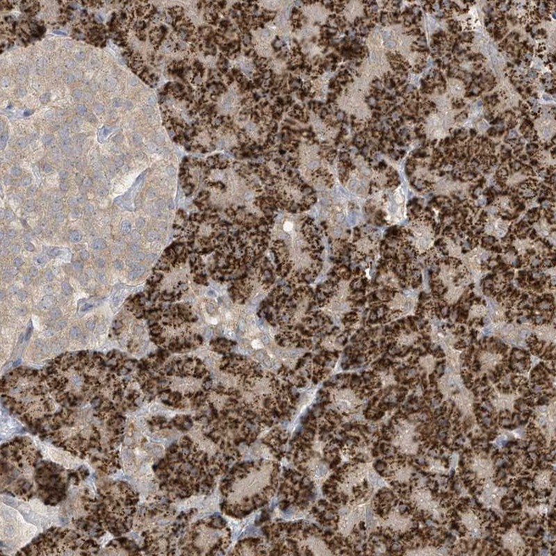 Atlas Antibodies Anti-LRRN2 Antibody
