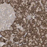 Atlas Antibodies Anti-LRRN2 Antibody
