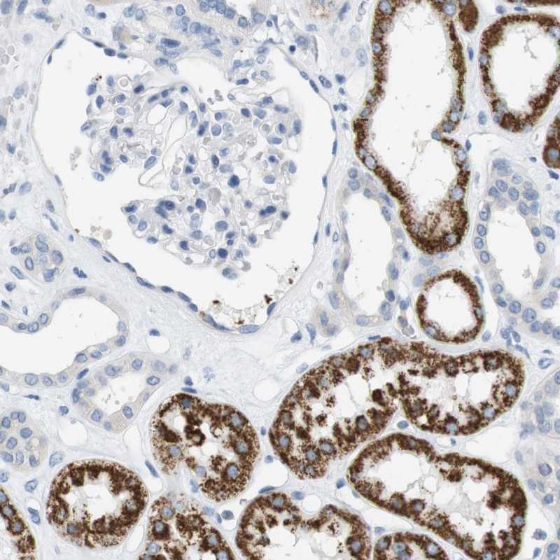 Atlas Antibodies Anti-LRRK2 Antibody