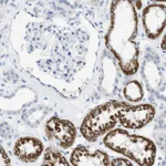 Atlas Antibodies Anti-LRRK2 Antibody
