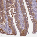 Atlas Antibodies Anti-AHCYL1 Antibody
