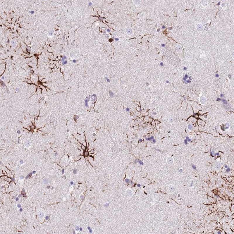 Atlas Antibodies Anti-LRRN3 Antibody