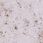Atlas Antibodies Anti-LRRN3 Antibody