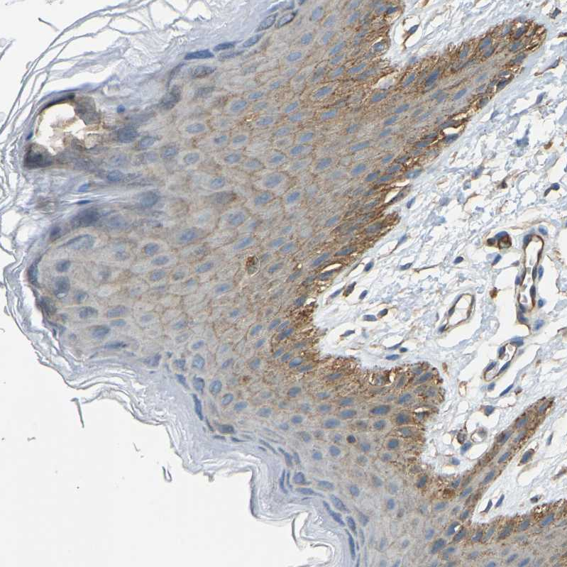 Atlas Antibodies Anti-AHNAK Antibody