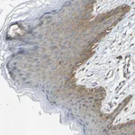 Atlas Antibodies Anti-AHNAK Antibody