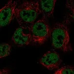 Atlas Antibodies Anti-LRRTM3 Antibody