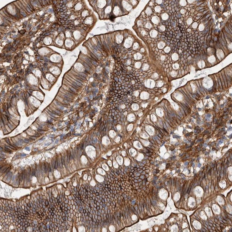 Atlas Antibodies Anti-AHNAK Antibody
