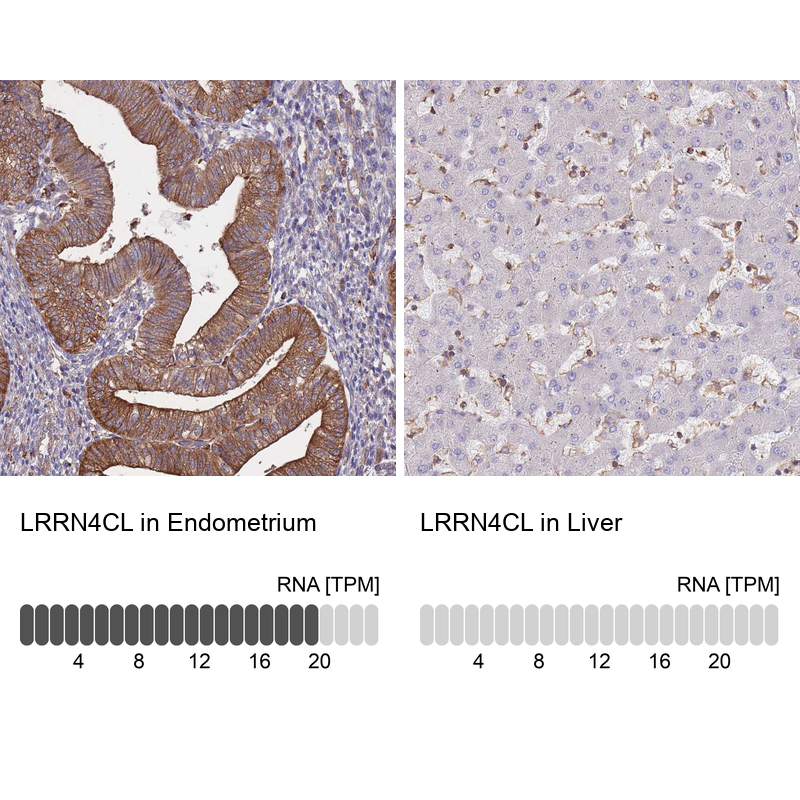 Atlas Antibodies Anti-LRRN4CL Antibody