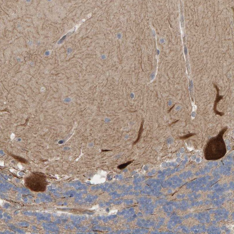Atlas Antibodies Anti-LRSAM1 Antibody