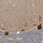Atlas Antibodies Anti-LRSAM1 Antibody