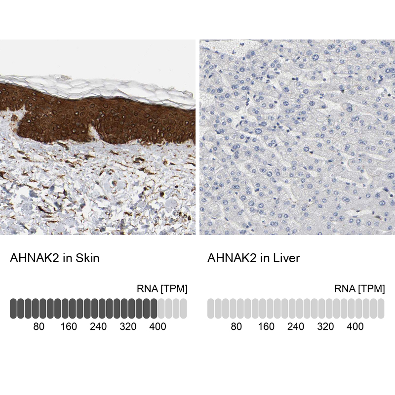 Atlas Antibodies Anti-AHNAK2 Antibody