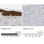 Atlas Antibodies Anti-AHNAK2 Antibody