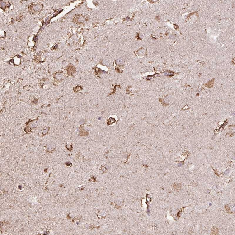 Atlas Antibodies Anti-LRTM2 Antibody