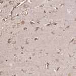 Atlas Antibodies Anti-LRTM2 Antibody