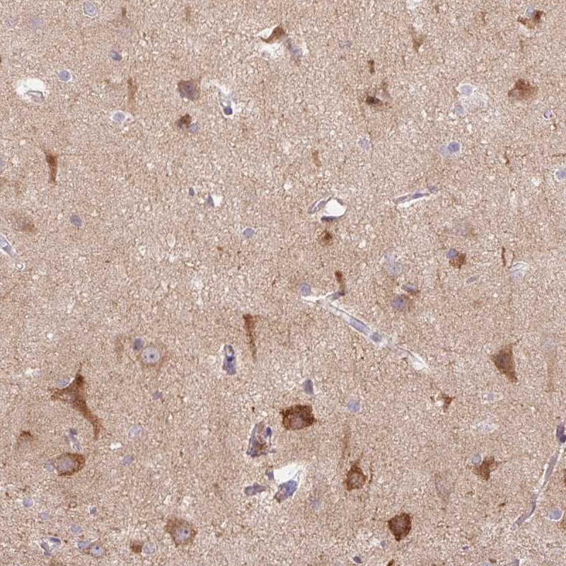 Atlas Antibodies Anti-LRRTM1 Antibody