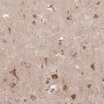 Atlas Antibodies Anti-LRRTM1 Antibody