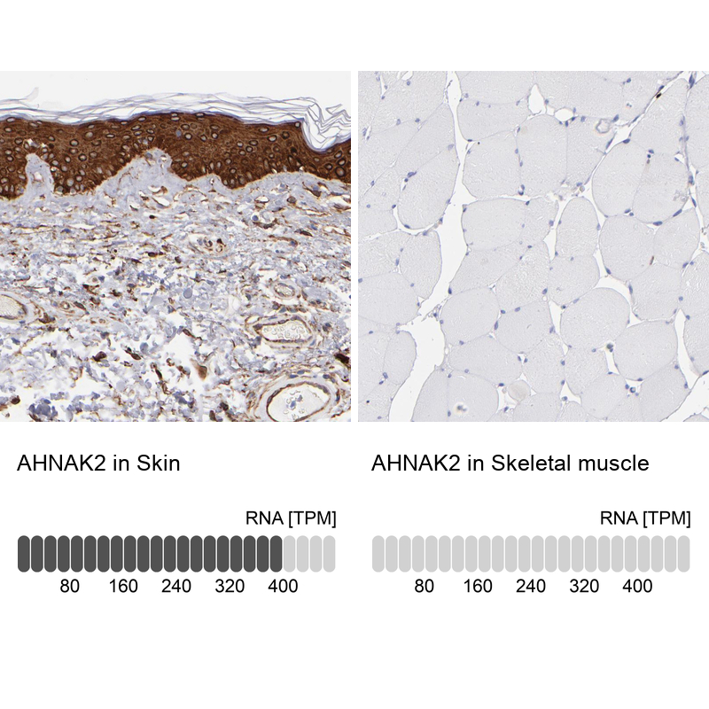 Atlas Antibodies Anti-AHNAK2 Antibody