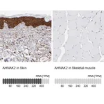 Atlas Antibodies Anti-AHNAK2 Antibody