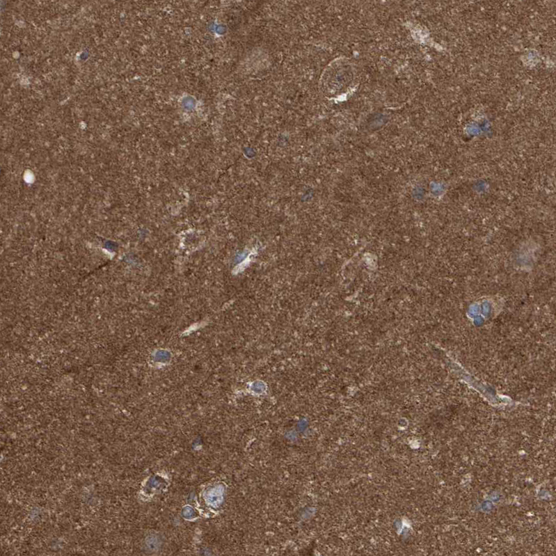 Atlas Antibodies Anti-LRSAM1 Antibody