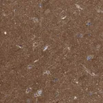 Atlas Antibodies Anti-LRSAM1 Antibody