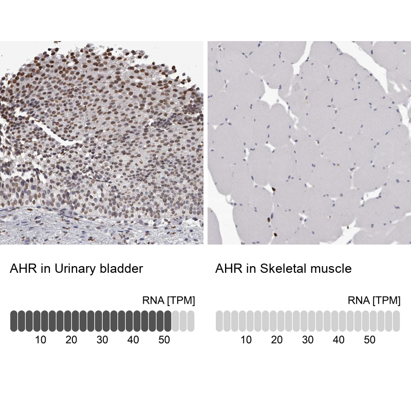 Atlas Antibodies Anti-AHR Antibody