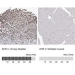 Atlas Antibodies Anti-AHR Antibody