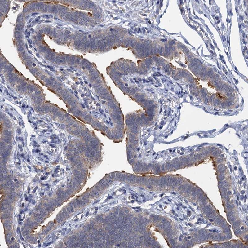 Atlas Antibodies Anti-LRTOMT Antibody
